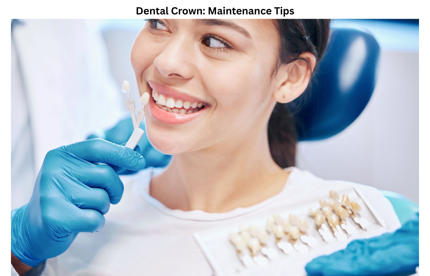 Dental Crown: Maintenance Tips